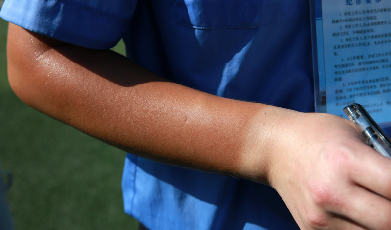炎炎夏日，鄂州車管所民警在考試中心為考生服務，因長期戴手套工作手臂晒成了“黑白手”。韓長鴻攝